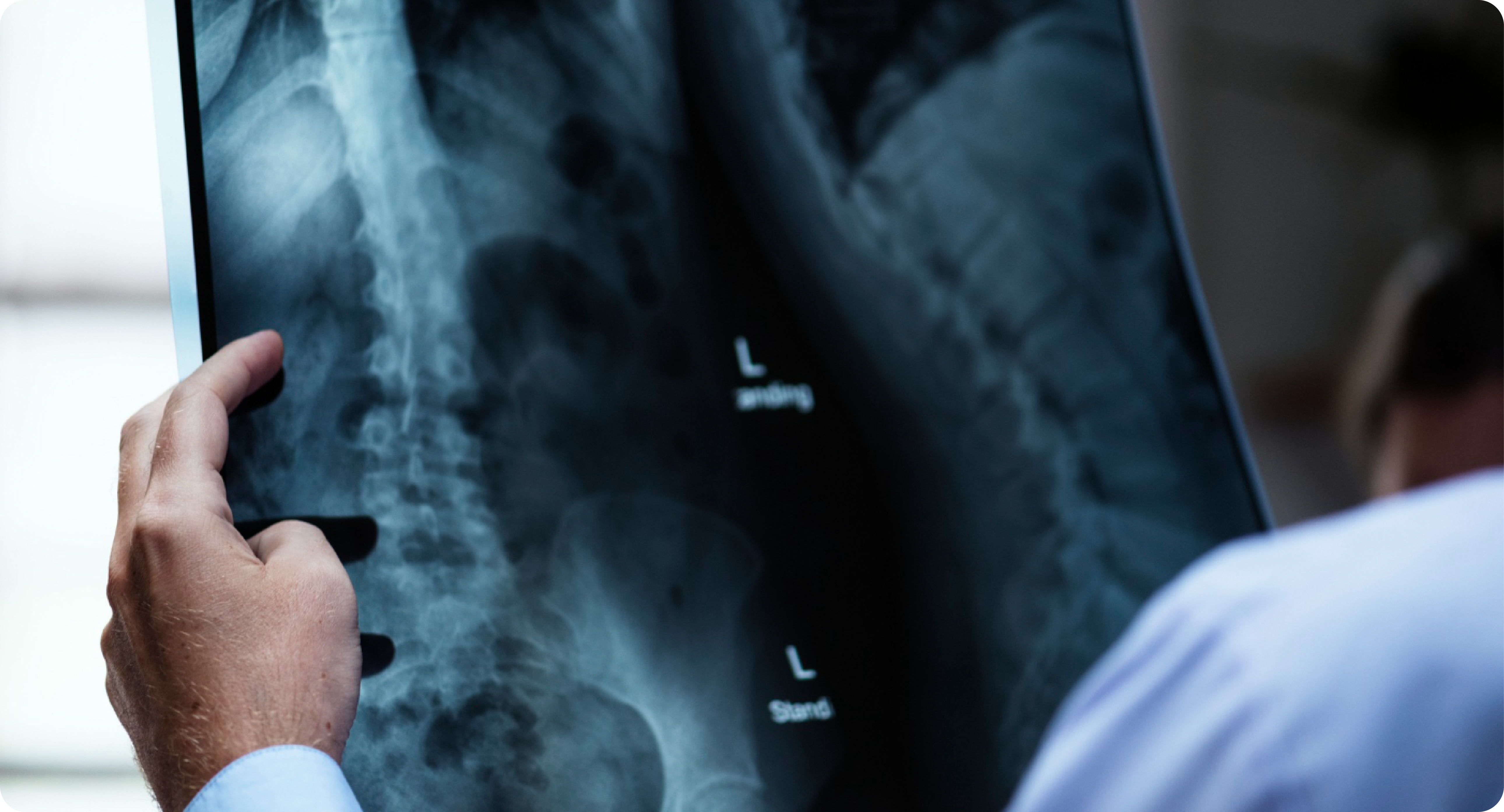 Profesional observa una radiografía de tórax en un visor de diagnóstico.